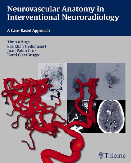 Neurovascular Anatomy in Interventional Neuroradiology: A Case-Based Approach