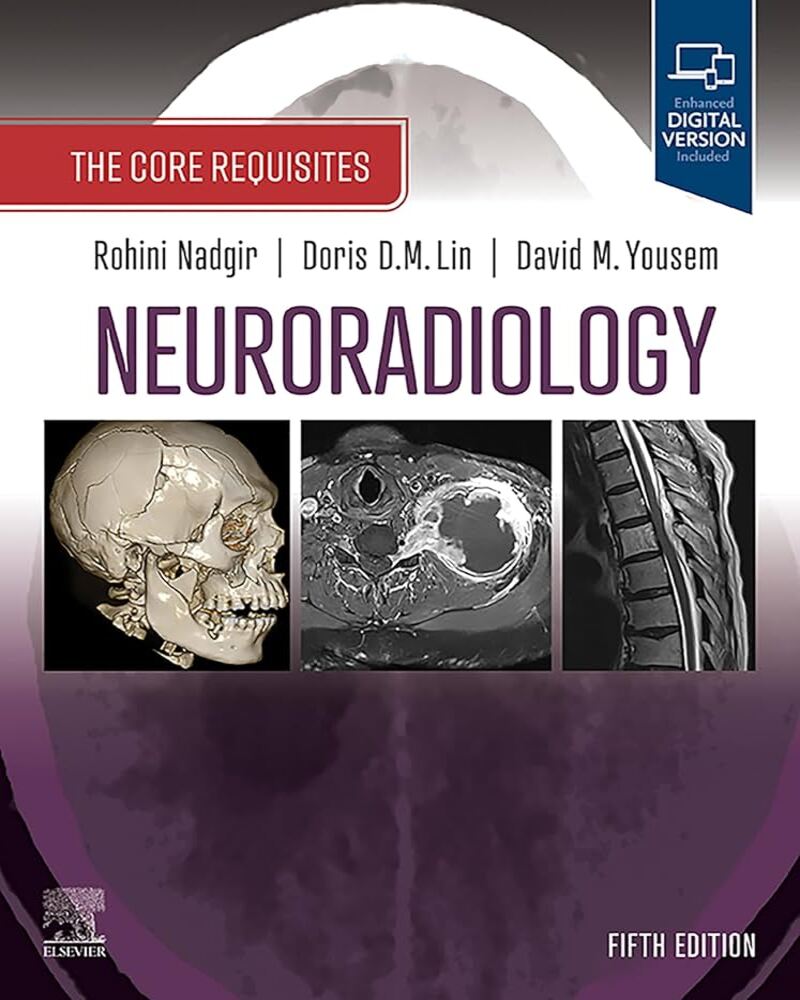 Neuroradiology: The Requisites E-Book: The Core Requisites