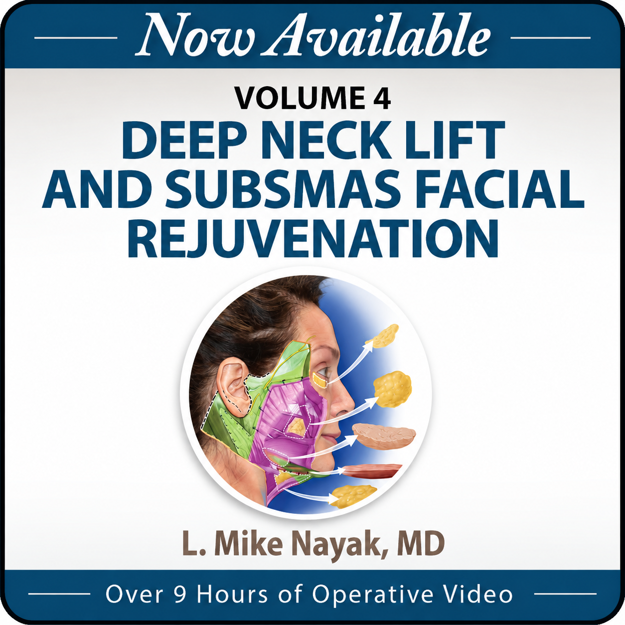 Advanced Deep Neck Lift & SubSMAS Facial Rejuvenation Masterclass 2026
